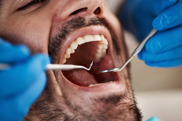 Best Emergency Treatment for Toothache in Myersville, MD